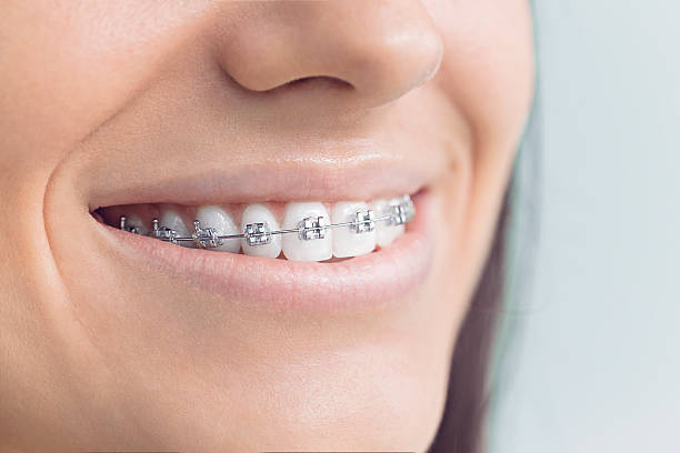 Trusted Aurora, NE  Holistic Dental Services Experts